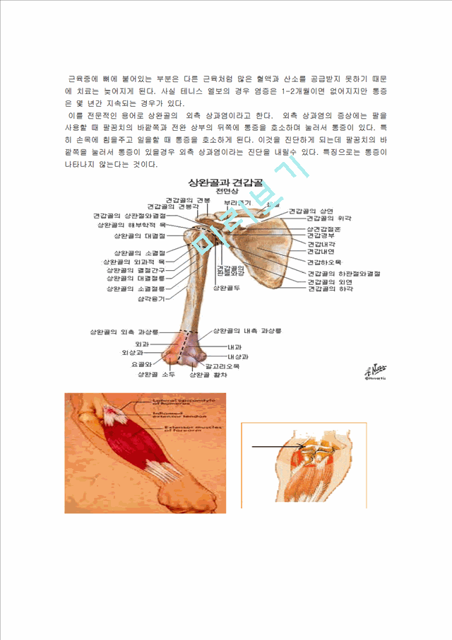 [의학,약학][의학] 테니스 엘보우에 대해서.hwp